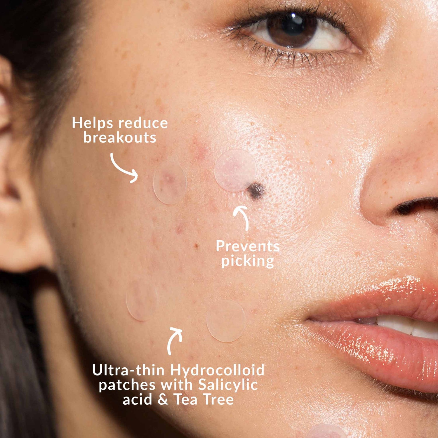 Blemish Breakdown Kit