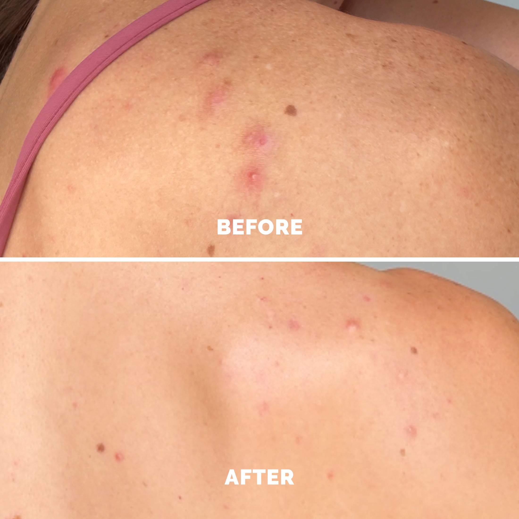 Blemish Control Face &amp; Body Mist
